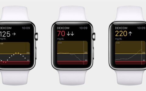 apple watch血糖测量系列series 7即将推出